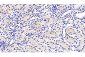 Detection of CEACAM1 in Human Kidney Tissue using Polyclonal Antibody to Carcinoembryonic Antigen Related Cell Adhesion Molecule 1 (CEACAM1) (CEACAM1 抗体)