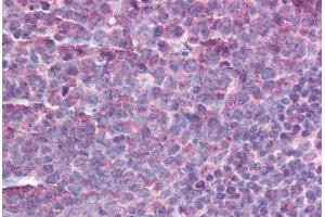 Human Tonsil (formalin-fixed, paraffin-embedded) stained with AICDA antibody ABIN214183 at 5 ug/ml followed by biotinylated goat anti-rabbit IgG secondary antibody ABIN481713, alkaline phosphatase-streptavidin and chromogen. (AICDA 抗体  (C-Term))