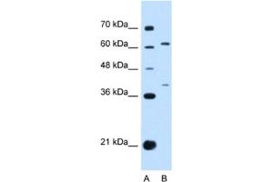 Western Blotting (WB) image for anti-Interleukin 28 Receptor, alpha (Interferon, lambda Receptor) (IL28RA) antibody (ABIN2463129) (IL28RA 抗体)