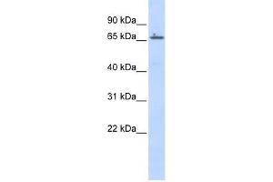 Human Placenta; WB Suggested Anti-ZNF503 Antibody Titration: 0. (ZNF503 抗体  (Middle Region))