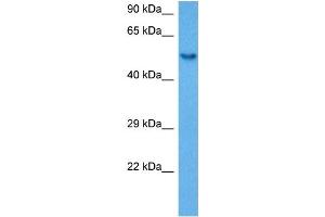 Host:  Rabbit  Target Name:  SP1  Sample Tissue:  Mouse Spleen  Antibody Dilution:  1ug/ml (SP1 抗体  (Middle Region))