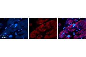 Rabbit Anti-CAP1 Antibody   Formalin Fixed Paraffin Embedded Tissue: Human heart Tissue Observed Staining: Plasma membrane Primary Antibody Concentration: N/A Other Working Concentrations: 1:600 Secondary Antibody: Donkey anti-Rabbit-Cy3 Secondary Antibody Concentration: 1:200 Magnification: 20X Exposure Time: 0. (CAP1 抗体  (Middle Region))