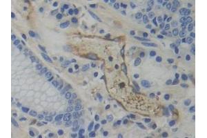 Immunohistochemistry (IHC) image for anti-Tryptophanyl-tRNA Synthetase (WARS) (AA 247-458) antibody (ABIN7441784)