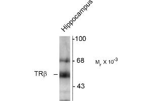 Western blots of hippocampal lysate showing specific immunolabeling of the ~58k TR-ß protein. (THRB 抗体  (N-Term))