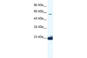 WB Suggested Anti-DDX55 Antibody Titration:  1. (DDX55 抗体  (C-Term))