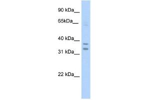WB Suggested Anti-NR1I3 Antibody Titration:  5. (NR1I3 抗体  (C-Term))
