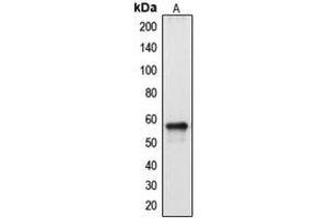 Western Blotting (WB) image for anti-Cytochrome P450, Family 2, Subfamily A, Polypeptide 13 (CYP2A13) (Center) antibody (ABIN7295438)