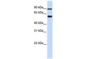 Image no. 1 for anti-Alcohol Dehydrogenase, Iron Containing, 1 (ADHFE1) (AA 288-337) antibody (ABIN6741163) (ADHFE1 抗体  (AA 288-337))