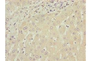 Immunohistochemistry of paraffin-embedded human liver tissue using ABIN7175794 at dilution of 1:100 (WDR74 抗体  (AA 111-366))