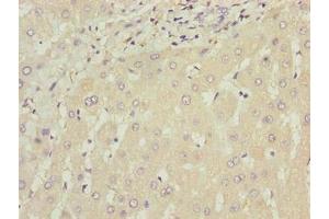 Immunohistochemistry of paraffin-embedded human liver tissue using ABIN7175794 at dilution of 1:100 (WDR74 抗体  (AA 111-366))