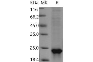 Western Blotting (WB) image for Sonic Hedgehog (SHH) (Active) protein (His tag) (ABIN7198797)