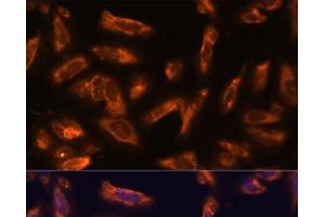 Immunofluorescence analysis of U-2 OS cells using CSF2 Polyclonal Antibody at dilution of 1:100. (GM-CSF 抗体)