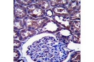NPC1 antibody immunohistochemistry analysis in formalin fixed and paraffin embedded human kidney tissue. (NPC1 抗体  (AA 591-620))