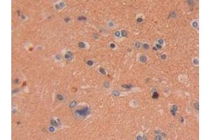 Detection of DDAH2 in Human Brain Tissue using Polyclonal Antibody to Dimethylarginine Dimethylaminohydrolase 2 (DDAH2) (DDAH2 抗体  (AA 31-265))
