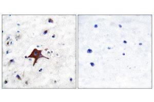 Immunohistochemistry (IHC) image for anti-Solute Carrier Family 2 (Facilitated Glucose Transporter), Member 3 (SLC2A3) (C-Term) antibody (ABIN1848584) (SLC2A3 抗体  (C-Term))