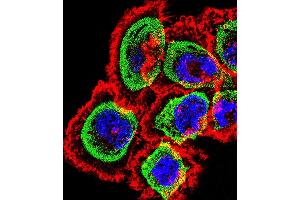 Fluorescent confocal image of A431 cell stained with RCAN1 Antibody (N-term) (ABIN1539360 and ABIN2848483). (RCAN1 抗体  (N-Term))
