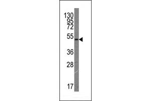 Western blot analysis of anti-VGFR3 Monoclonal Antibody (ABIN387818 and ABIN2843906) by VGFR3 recombinant protein(Fragment 50KD). (FLT4 抗体)