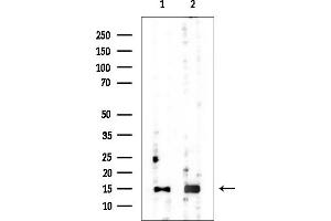 anti-Chromosome 8 Open Reading Frame 4 (C8orf4) antibody