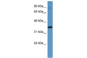 Western Blotting (WB) image for anti-Mitogen-Activated Protein Kinase-Activated Protein Kinase 3 (MAPKAPK3) (C-Term) antibody (ABIN2788403) (MAPKAP Kinase 3 抗体  (C-Term))