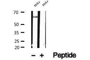 Western blot analysis of extracts of HeLa cells, using NFKBIZ antibody. (NFKBIZ 抗体  (Internal Region))