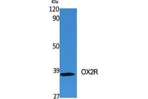 Western Blot (WB) analysis of specific cells using OX2R Polyclonal Antibody. (HCRTR2 抗体  (C-Term))