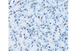 Immunohistochemistry of paraffin-embedded Rat pancreas using HNF4A Polyclonal Antibody at dilution of 1:100 (40x lens). (HNF4A 抗体)