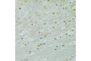 Immunohistochemistry of paraffin-embedded mouse brain using RCC1 antibody (ABIN5973761) at dilution of 1/100 (40x lens). (RCC1 抗体)