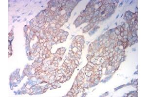Immunohistochemistry (IHC) image for anti-Keratin 18 (KRT18) (AA 1-150) antibody (ABIN7193470)