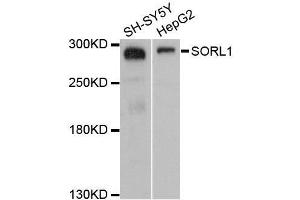 Western blot analysis of extracts of various cell lines, using SORL1 antibody. (SORL1 抗体  (AA 2065-2214))