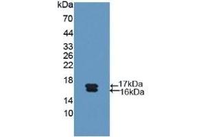 Detection of Recombinant Glycocalicin, Human using Polyclonal Antibody to Glycocalicin (GC) (Glycocalicin 抗体  (AA 136-276))