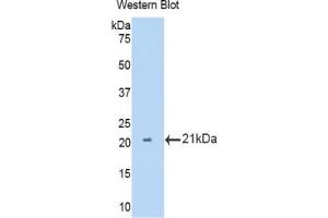 Western blot analysis of the recombinant protein. (IL12RB2 抗体  (AA 455-606))