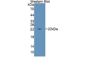 Western blot analysis of the recombinant protein. (TRERF1 抗体  (AA 785-942))
