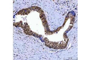 IHC analysis of SSRP1 using anti-SSRP1 antibody (ABIN7600496). (SSRP1 抗体  (AA 2-381))
