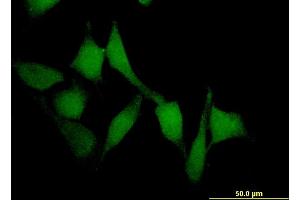 Immunofluorescence of monoclonal antibody to SMAD7 on HeLa cell. (SMAD7 抗体  (AA 302-400))