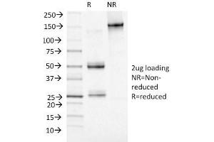 SDS-PAGE Analysis Purified Adipophilin Mouse Monoclonal Antibody (ADFP/1493). (ADRP 抗体  (AA 249-376))