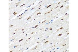Immunohistochemistry of paraffin-embedded Rat heart using HNRNPR Polyclonal Antibody at dilution of 1:100 (40x lens). (HNRNPR 抗体)