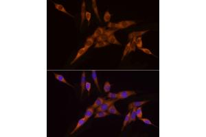 Immunofluorescence analysis of PC-12 cells using N Rabbit mAb (ABIN7268773) at dilution of 1:200 (40x lens). (NAT1 抗体)