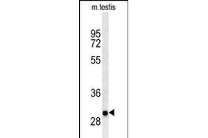 ITGB1BP3 Antibody (Center) (ABIN650725 and ABIN2839412) western blot analysis in mouse testis tissue lysates (35 μg/lane). (ITGB1BP3 抗体  (AA 156-186))