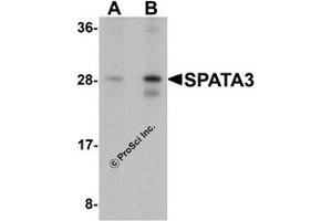 Western Blotting (WB) image for anti-Spermatogenesis Associated 3 (SPATA3) (C-Term) antibody (ABIN1077366) (SPATA3 抗体  (C-Term))
