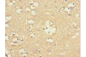 Immunohistochemistry of paraffin-embedded human brain tissue using ABIN7161350 at dilution of 1:100 (CHRNA9 抗体  (AA 26-240))