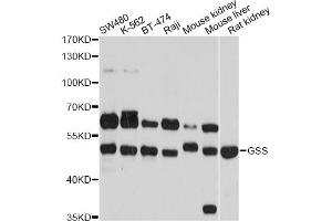 anti-Glutathione Synthetase (GSS) antibody