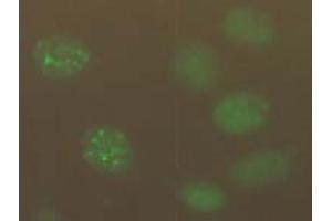 Immunofluorescence (IF) image for anti-Chromatin Assembly Factor 1, Subunit B (p60) (CHAF1B) antibody (ABIN1105633) (CHAF1B 抗体)