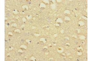 Immunohistochemistry (IHC) image for anti-Solute Carrier Family 24 (Sodium/potassium/calcium Exchanger), Member 1 (SLC24A1) (AA 330-452) antibody (ABIN7170057)