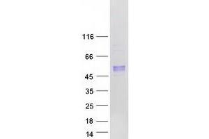 Western Blotting (WB) image for Arylsulfatase B (ARSB) (Transcript Variant 2) protein (Myc-DYKDDDDK Tag) (ABIN2714958)