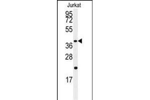 Western blot analysis of anti-CASP9 Antibody  (ABIN1881137 and ABIN2842071) in Jurkat cell line lysates (35 μg/lane). (Caspase 9 抗体  (Ser196))