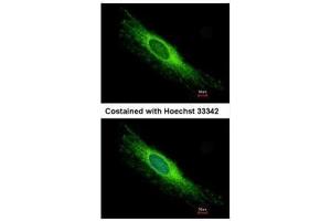 ICC/IF Image Immunofluorescence analysis of methanol-fixed HeLa, using PEX26, antibody at 1:500 dilution. (PEX26 抗体)
