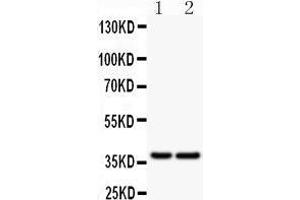 Western Blotting (WB) image for anti-B-cell antigen receptor complex-associated protein alpha chain (CD79A) (AA 121-226) antibody (ABIN3043397) (CD79a 抗体  (AA 121-226))
