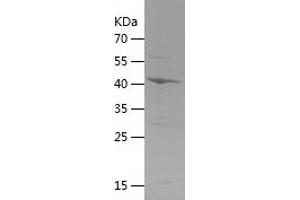 Endonuclease G Protein (ENDOG) (AA 23-212) (His-IF2DI Tag)