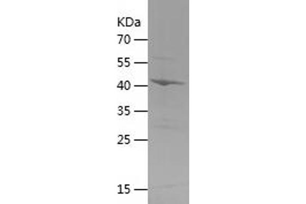 Endonuclease G Protein (ENDOG) (AA 23-212) (His-IF2DI Tag)