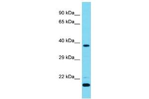 Host: Rabbit  Target Name: Camk1d  Sample Tissue: Mouse Testis lysates  Antibody Dilution: 1. (CAMK1D 抗体  (N-Term))